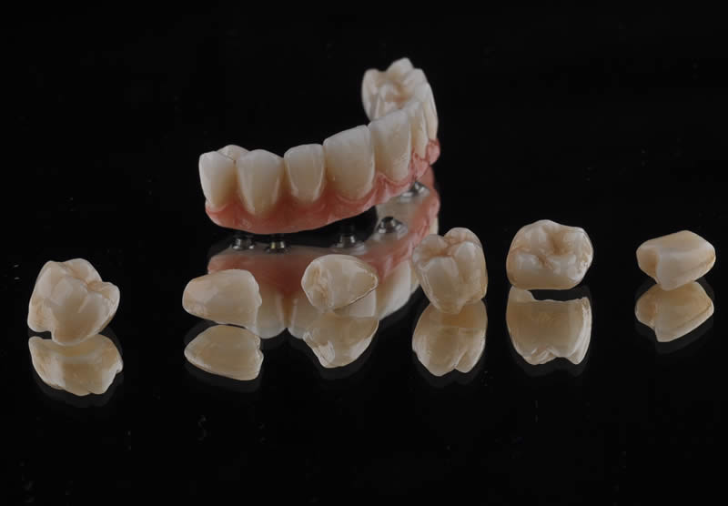 About Your Expert Dental Technicians Middlesex Primo Dental Laboratory